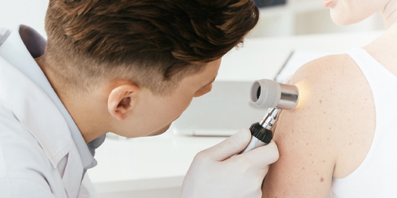 Skin Cancer